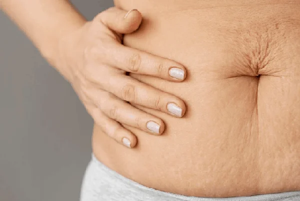 Cosmetic Gynaecology