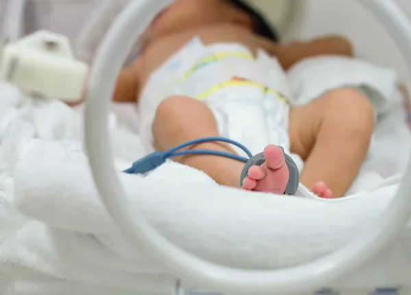 Preterm Delivery